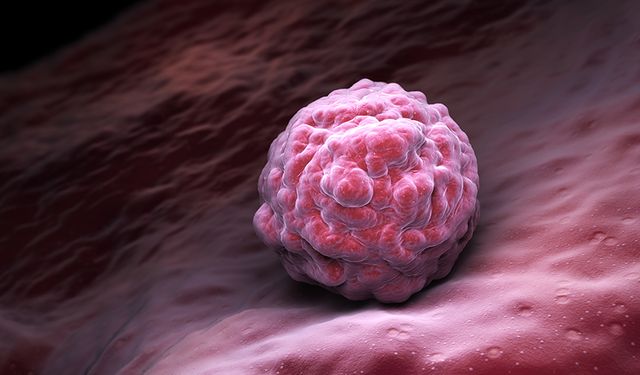 Kanser Genetik Olarak Aktarılabilir mi?